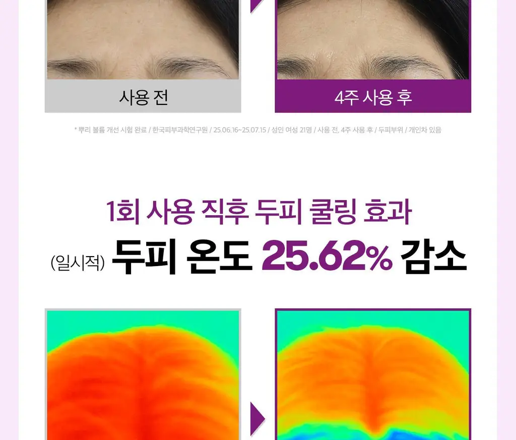 [더블기획][뿌리볼륨/탈모관리] VT 리들샷 헤어 부스팅 앰플 100디엘 단품/기획 2종 택 1 상세페이지 13
